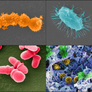 Image of Creating Microbiomes That Improve Human and Environmental Health