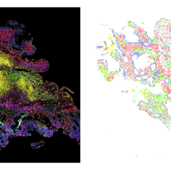 Computer vision is used to find cells in a high-content image of an immune response in the colon (left). In the right, each dot is a cell found by the computer, with different colors encoding different immune cell and colon cell types.